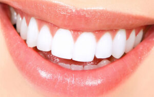 Cosmetic Dental Work – Dental Technology for any Beautiful Smile